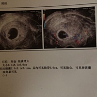 又会看B超的宝妈吗？男孩女孩？