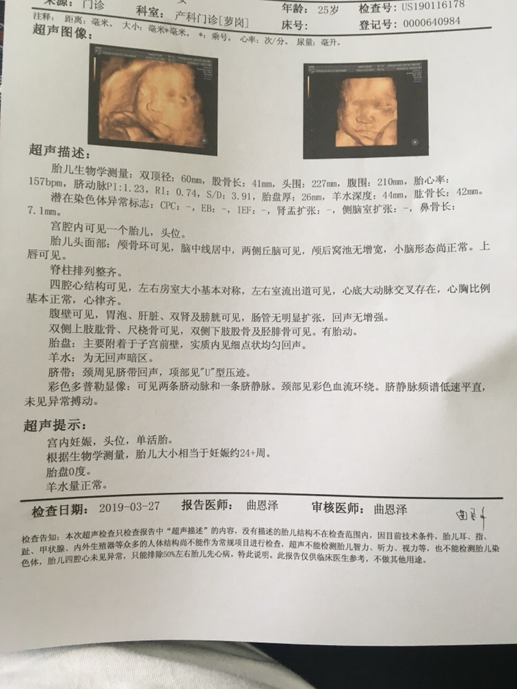 娱乐娱乐，宝妈们猜猜，生了开奖。