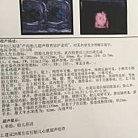 三维做了三次才过，不知道是男宝还是女宝。
