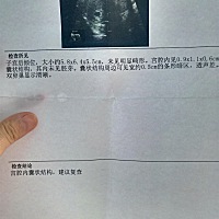 有会看B超的妈妈么？男宝女宝呢？