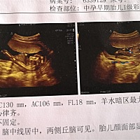 请各位帮忙看看我家宝宝是男是女。 16 周