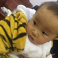 宝宝床上摔下来了 额头消肿以后一个坑 会不会恢复啊，都差不多一个月了，好自责啊