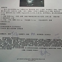 怕早产，哪位大神给算算现在大概多少斤了。