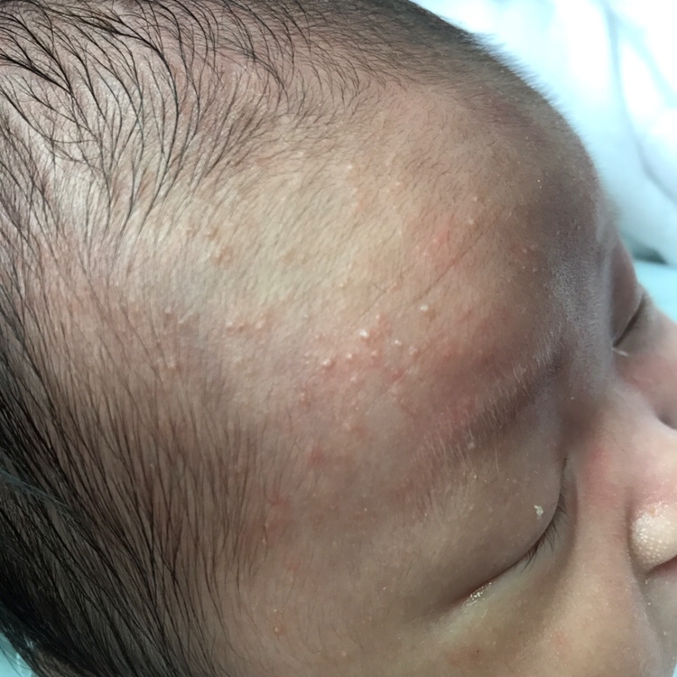 宝宝额头长的是啥东东