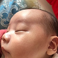 宝贝快长这个不知道啥东西的一粒粒的，要怎么预防不让他变严重，还是现在就涂什么？