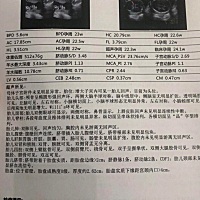 有没有能看懂B超单子的！帮忙看看男孩还是女孩