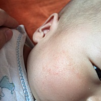 宝妈们帮忙看下这是怎么了？