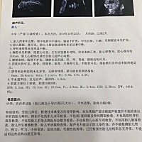 大排畸过了，希望你是个小棉袄