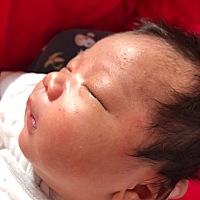 宝贝23天，脸上的会消下去 但是会长新的出来，脖子的感觉和脸上不大一样，有涂婴宝，有这样经验的传授一...