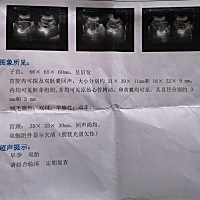 大家帮我来看看男女，双胞胎，根据孕囊推测男女真的准吗，医生又跟我说这个不是很准的，很纠结，我头胎...