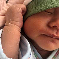 请问婴儿湿疹用什么药会好？着急啊