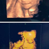小家伙还会笑了 医生说眉眼长的像我，笑起来跟老公一摸一样。我们俩的结合体