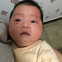 请问各位宝妈，这是热的，还是湿疹？ 这两天睡觉几分钟就被吓醒， 一闹一哭更严重了。 现在都是抱着睡，...