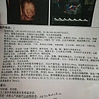有帮忙看一下是男宝还是女宝的吗