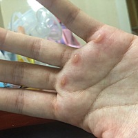 3-27生下大胖小子7斤8两一个，生的太辛苦了，手上磨了8个水泡，喝了7罐红牛，打了两天缩宫素一直打...