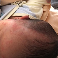 宝妈们，新手宝妈一枚，宝宝1个半月了脸上头上长了好多疹子，都十几天了，你们有遇到过这种吗？都是怎么...