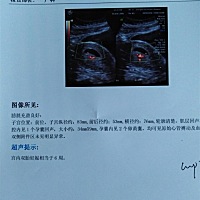 但是还是吃不下东西