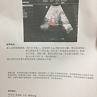 有怀孕37的宝妈吗？可以看出是男宝女宝？