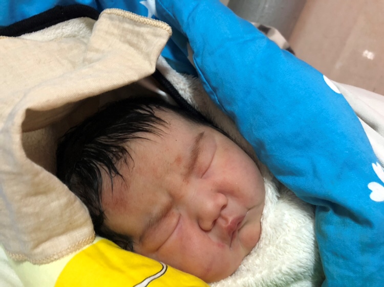 来报道了。头胎男孩，二胎女孩40周 1天剖的，顺产的罪也受了，医生说小孩太大子疤痕子宫厚度1~1.7毫米，太薄，如是顺的话有子宫破裂的风险，规律宫缩了，羊水也破的，整个孕期胖了26斤，小孩剖出来8.8斤整，好字凑