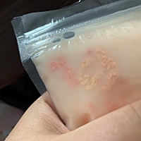 有宝妈吸出来的奶有这样子的东西吗，这是啥呀