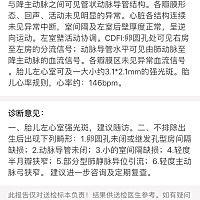 怀孕在肚子里就检查出左心室有强光斑，明天去复查，不知道有没有消下去