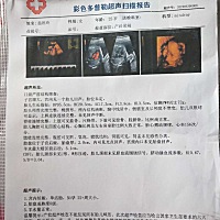 有会看男孩女孩的吗，帮我看下这是男孩女孩