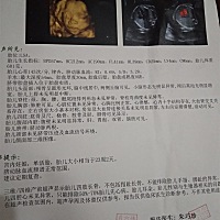 有谁会看男孩女孩？准备买衣服了，但是又不知道是男孩女孩