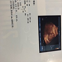 35周正常吗？需要怎么做呢？