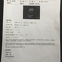 宝妈们，帮忙看看男孩女孩啊，youdianhaoqg，38周