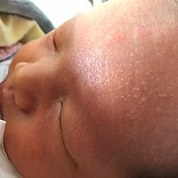 宝妈们，有谁知道我宝宝额头上的是什么？