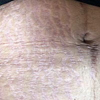 产后55天的肚子我真的是看着都想哭