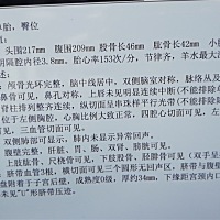 有经验的看看是男孩还是女孩？