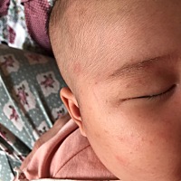 不知道是不是湿疹 反复的长 擦了药还是反反复复的长 只有脸上跟头上 身上没有 该怎么办啊 就穿一件小背...