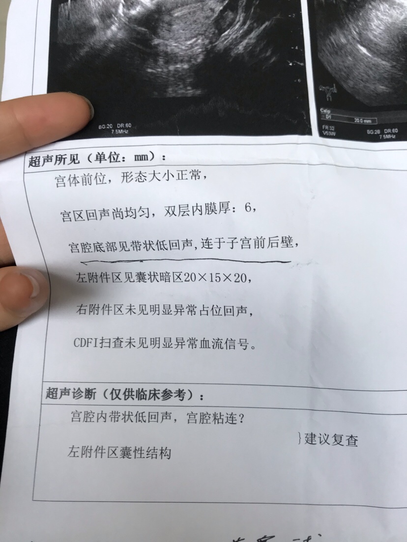 有没有这种情况的，医生让我做手术。