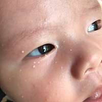 有宝妈知道脸上身上的白点点是什么吗，有什么药涂，看着像脂肪粒，可是太多了