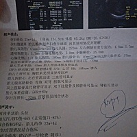 刚做的四维说宝宝头比正常大一周，这些正常吗，做唐筛的时候ntd高危风险，有没有关系好着急，