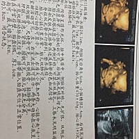 猜男女，好奇，大家娱乐一下呗