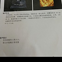 老婆NT正常  医生说有点高了  建议做无创  担心死了