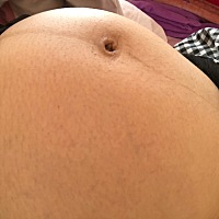 多少周能刨腹产？