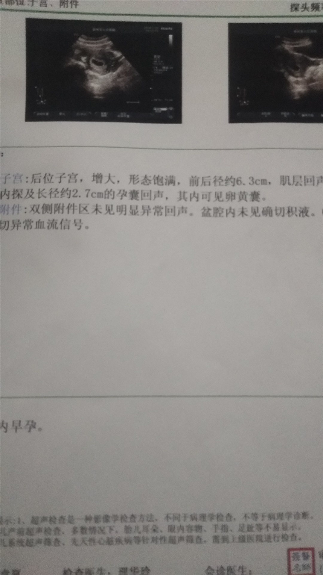 要几周就能听见了？谁能告诉我？