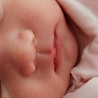 宝宝鼻子上的白色的小点点是什么啊，