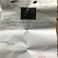 今天早上8点多做的卵泡监测，今天早上7点多还没做卵泡监测的时候同房了。那今天晚上还要同房吗？有没有...