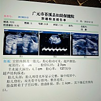有会看的吗，帮我看下是乔治还是佩奇