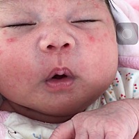 问下宝妈们，宝宝二十多天了，这两天晚上起的，肚子上也有，这怎么弄，是不是火气大长得，混合喂养，喂...