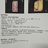今天3维顺利通过，宝宝很给力，一次就通过了 .就是看去没有人家的4维那么清晰，希望你平安健康出生，下...