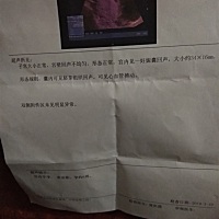 孕8周，有会看男女的吗