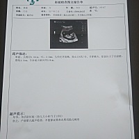 156次/分，是女孩的几率大，对不对？(*^ω^*)