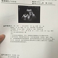 老婆二胎。月底生。是男是女？期待(๑˙ー˙๑)