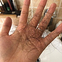 产后掉发怎么办…(˶‾᷄ ⁻̫ ‾᷅˵)感觉洗个头自己要秃了呜呜呜～