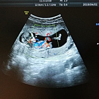 朋友们，大家来猜猜是男孩还是女孩吧😊